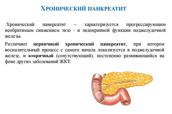 Заболевания поджелудочной панкреатит. Поджелудочная железа человека. Х0роническиипанкреотит. Хронический панкреатит. Хронический панкреатит характеризуется.